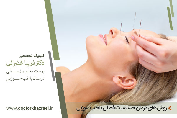 طب سوزنی و حساسیت فصلی