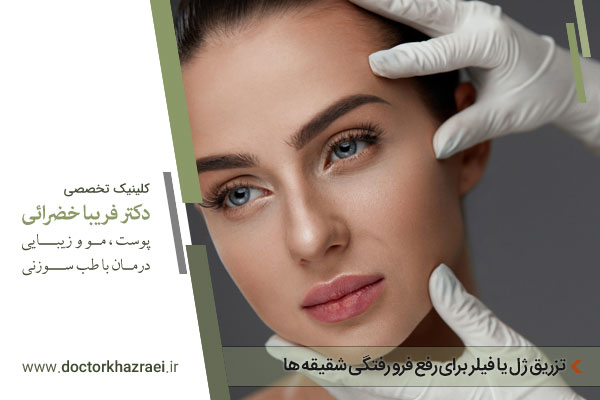 تزریق فیلر برای رفع گودی شقیقه