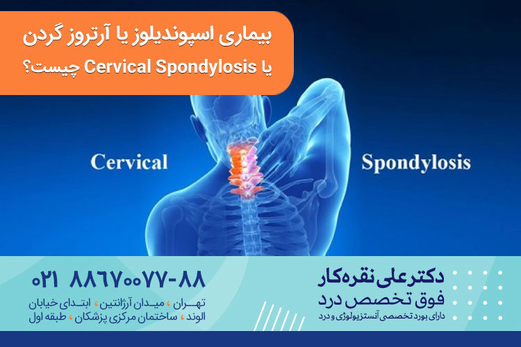 بیماری اسپوندیلوز یا آرتروز گردن 