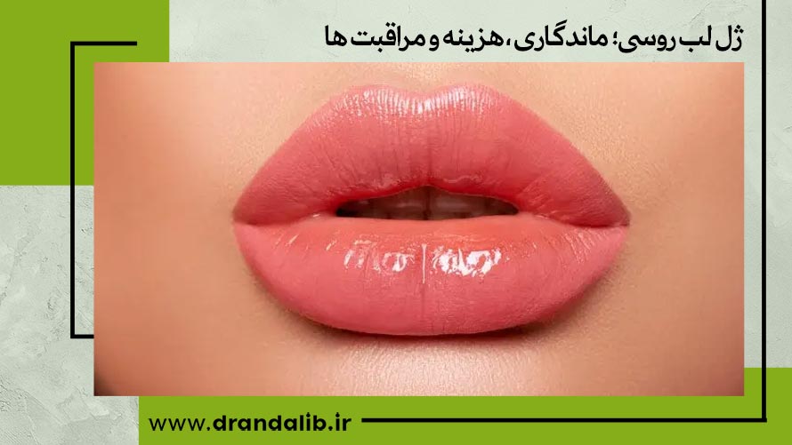 تزریق ژل لب مدل روسی در اصفهان 