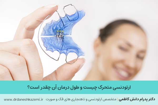 عکس  ارتودنسی متحرک