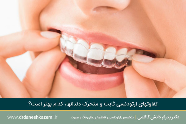 مقایسه تفاوتهای انواع ارتودنسی ثابت و متحرک