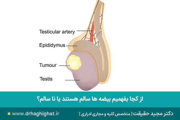 سلامت بیضه