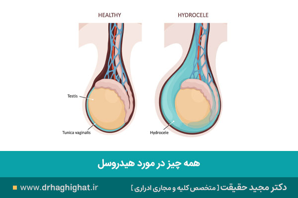 هیدروسل