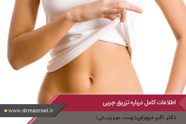 تزریق چربی دکتر مزروعی