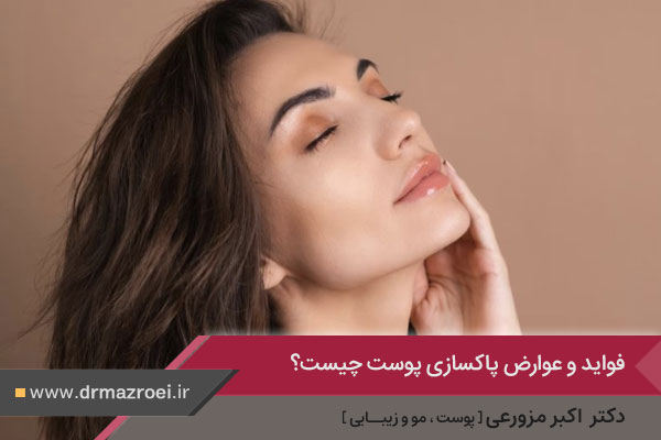 فواید و عوارض پاکسازی پوست 