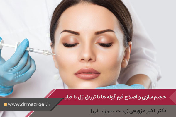 اصلاح فرم گونه ها با تزریق ژل یا فیلر