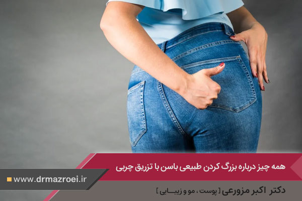 تزریق چربی به باسن در اصفهان 