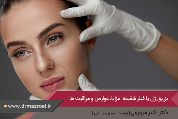 تززیق فیلر به شقیقه در اصفهان 