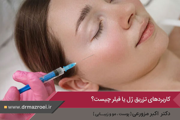 کاربردهای تزریق فیلر یا ژل 