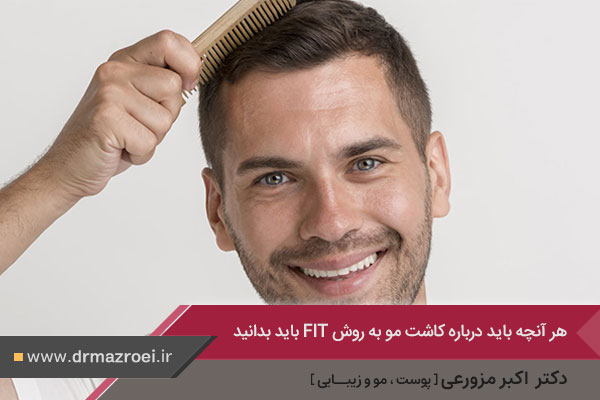 کاشت مو به روش fit در اصفهان 