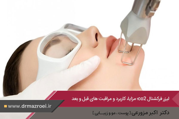 عکس لیزر فرکشنال co2