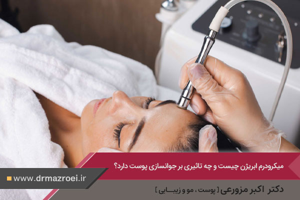 عکس میکرودرم ابریژن