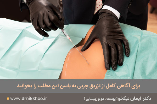 تزریق چربی به باسن