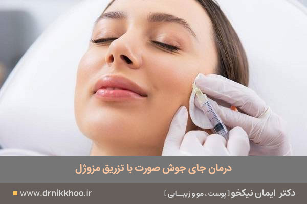 مزوژل جای جوش