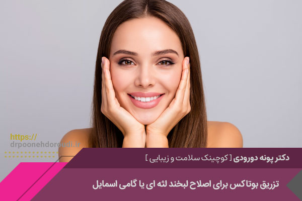 تزریق بوتاکس لبخند لثه ای در اصفهان 