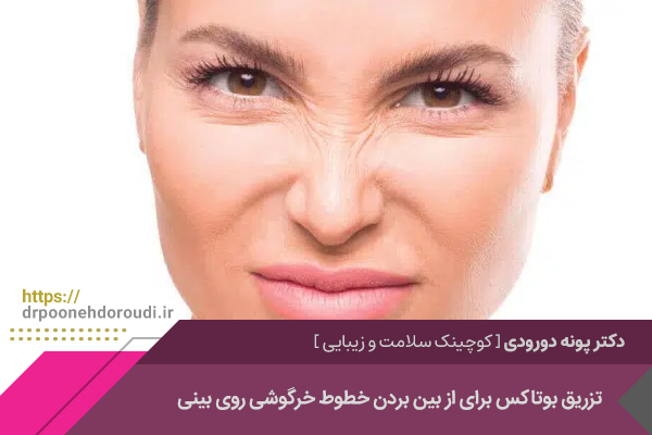 تزریق بوتاکس خطوط خرگوشی روی بینی 