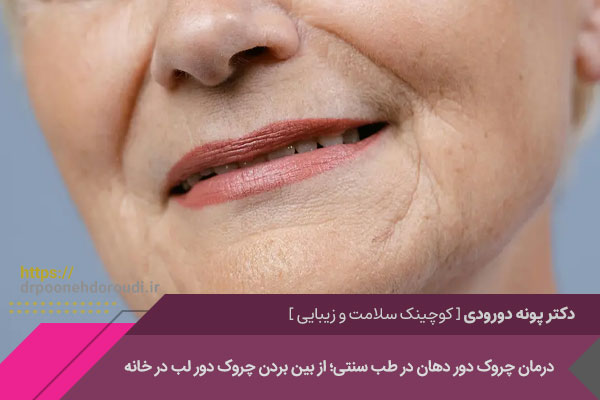 راه رهایی از چروکهای دور لب با طب سنتی 