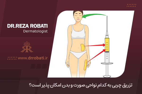 تزریق چربی به نواحی مختلف صورت و بدن