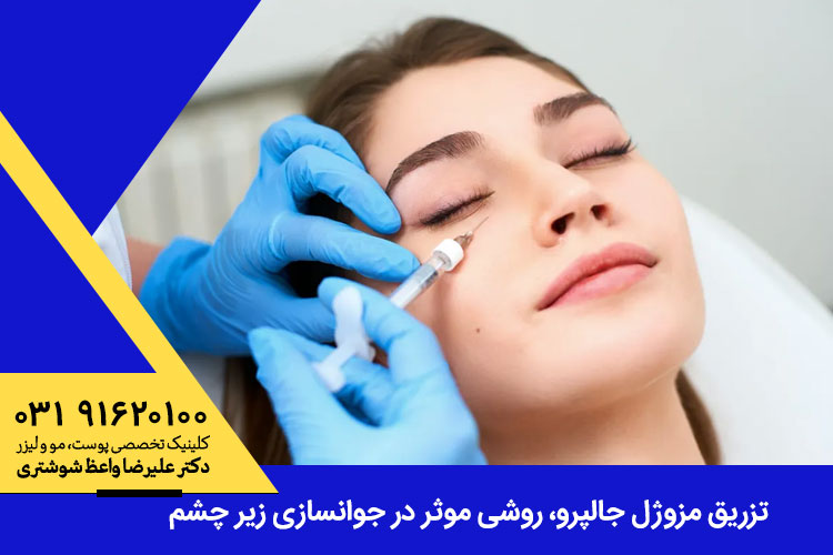 تزریق مزوژل جالپرو دراصفهان 