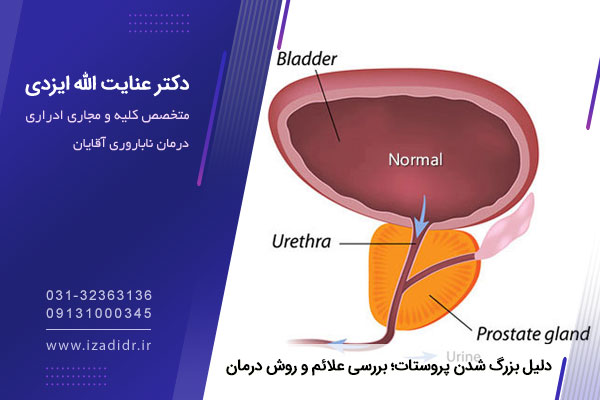 دلایل بزرگ شدن پروستات 