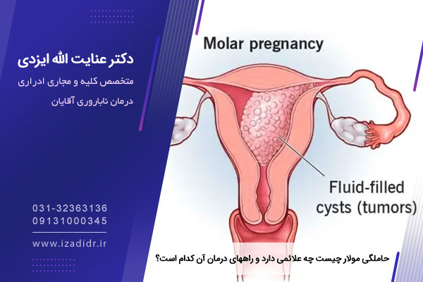 حاملگی مولار چیست