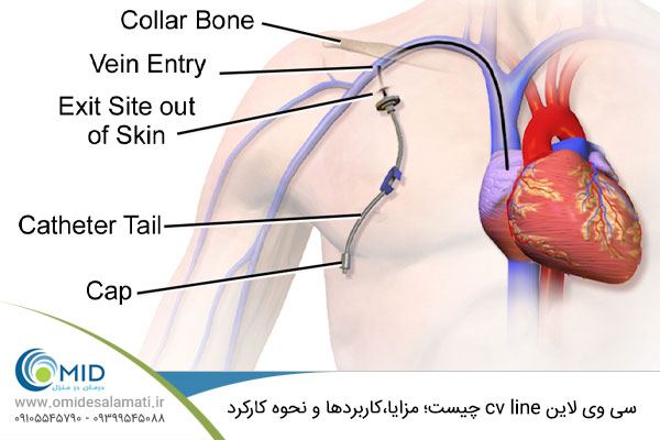 دستگاه سی وی لاین در منزل