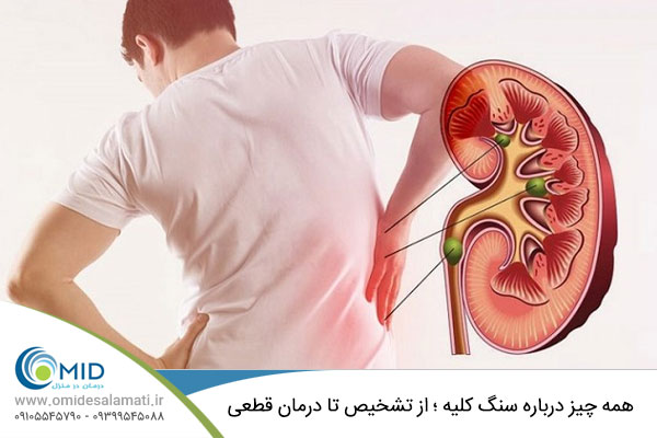 اطلاعات جامع درباره سنگ کلیه 