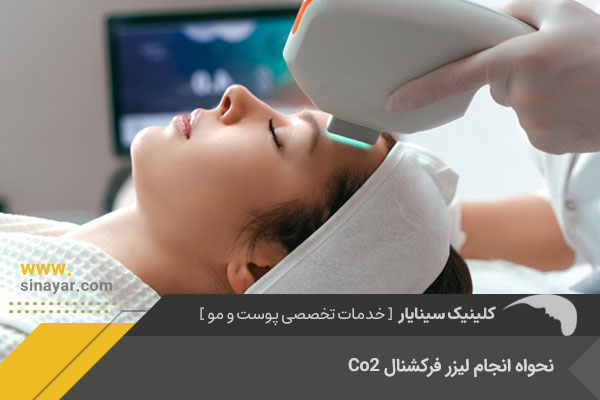 لیزر فرکشنال Co2 در اصفهان