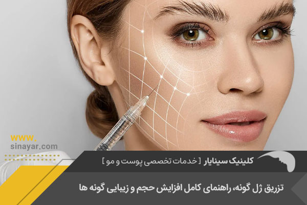 تزریق ژل گونه در اصفهان