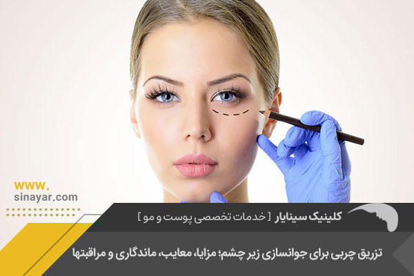 تزریق چربی زیر چشم در اصفهان