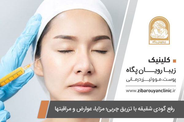 رفع گودی شقیقه با تزریق چربی