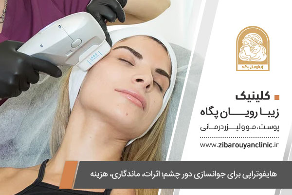 اثرات هایفوتراپی در لیفت و جوانسازی دور چشم