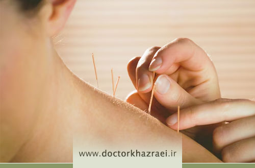 طب سوزنی چه بیماری هایی را درمان می کند؟