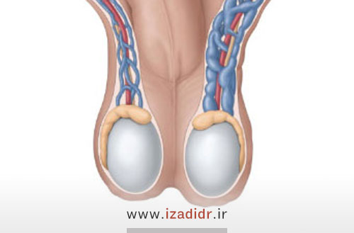 همه چیز درباره واریکوسل؛علائم،علت،تشخیص